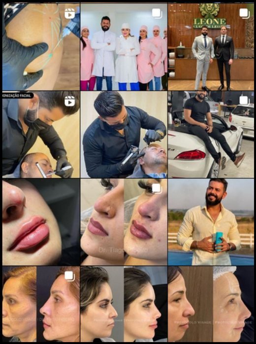 Feed de @drtiagoribeiro antes da gestão da REC INNOVE